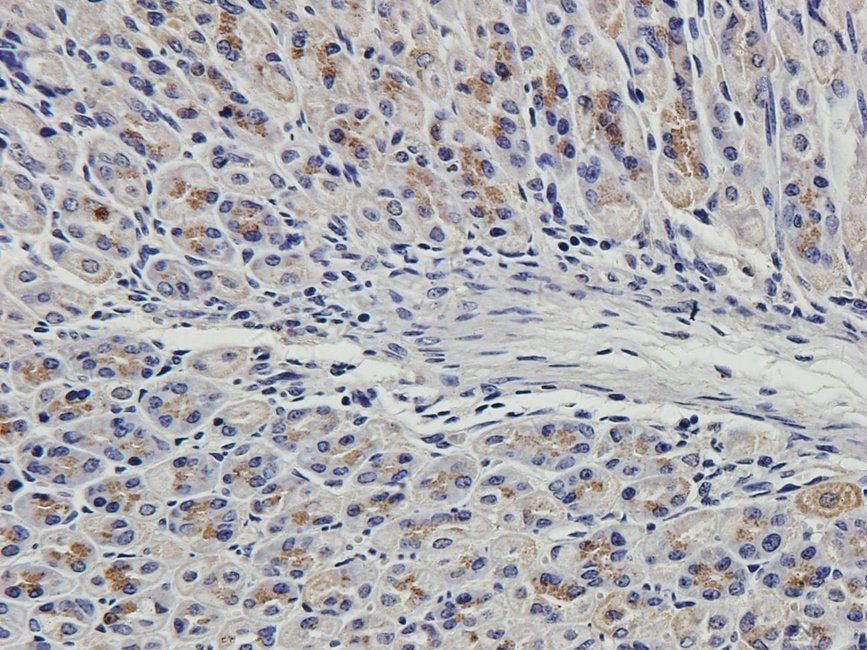 CD163 Rabbit Polyclonal Antibody