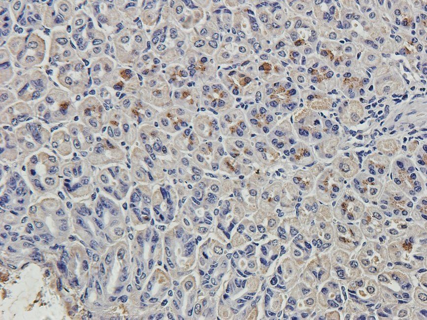 CD163 Rabbit Polyclonal Antibody