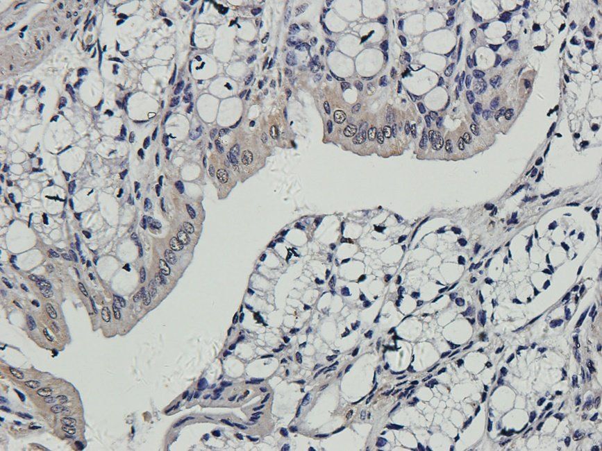 CD163 Rabbit Polyclonal Antibody