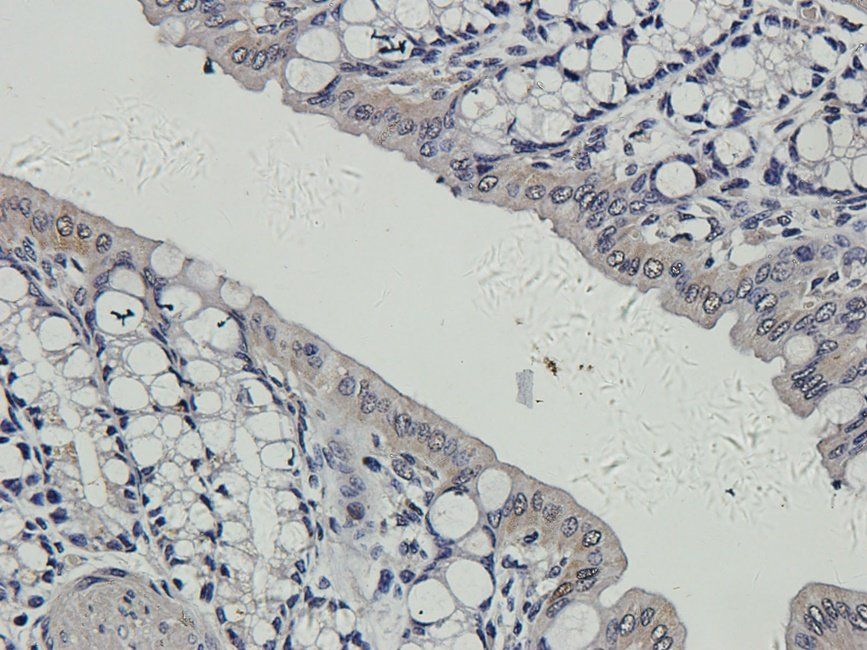 CD163 Rabbit Polyclonal Antibody