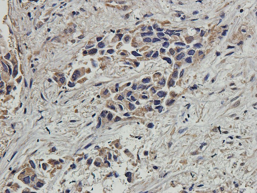 CD163 Rabbit Polyclonal Antibody