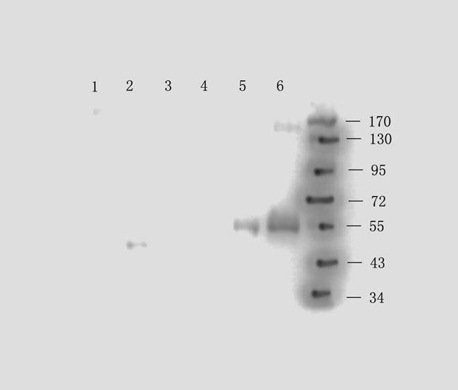 CD163 Rabbit Polyclonal Antibody