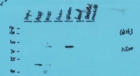 CD163 Rabbit Polyclonal Antibody