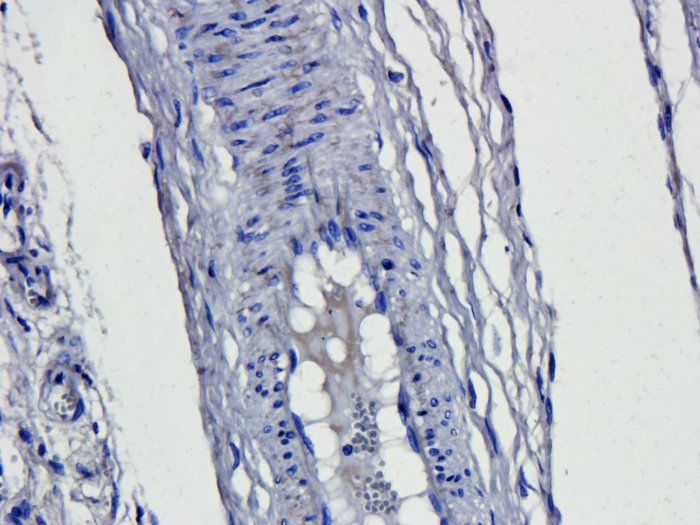 CD163 Rabbit Polyclonal Antibody