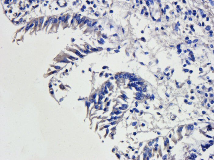 CD163 Rabbit Polyclonal Antibody