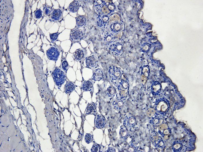 CD163 Rabbit Polyclonal Antibody