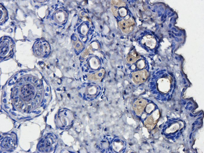 CD163 Rabbit Polyclonal Antibody