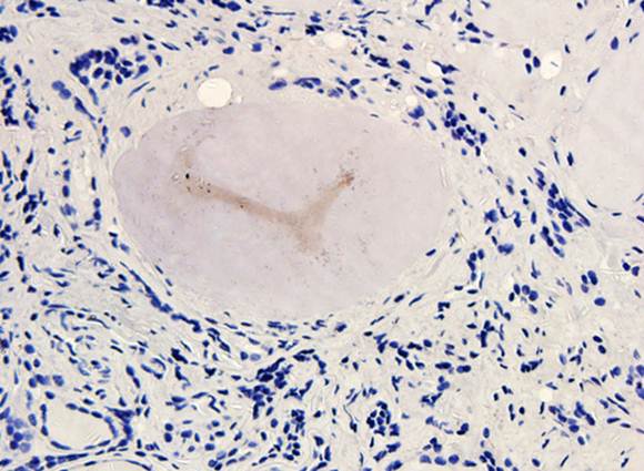 CD163 Rabbit Polyclonal Antibody