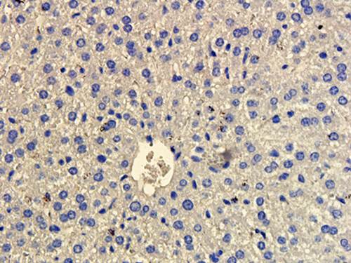CD163 Rabbit Polyclonal Antibody
