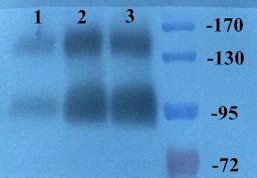 CD163 Rabbit Polyclonal Antibody