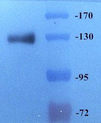 CD163 Rabbit Polyclonal Antibody