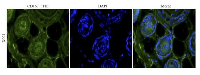 CD163 Rabbit Polyclonal Antibody (FITC)