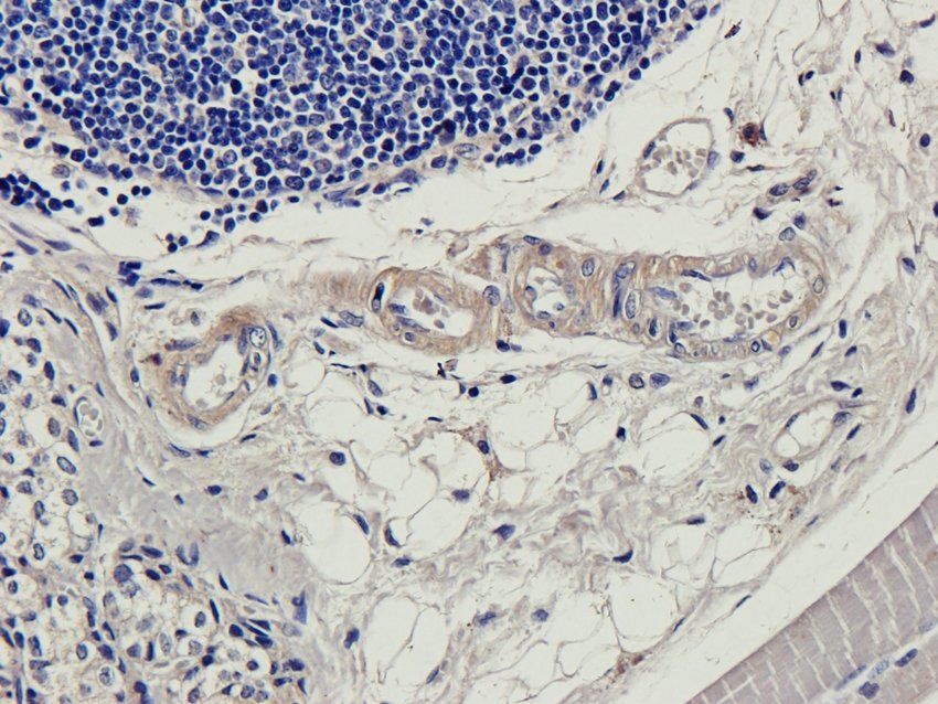 CD166 Rabbit Polyclonal Antibody