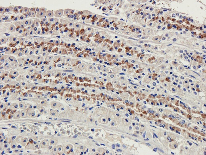 CD166 Rabbit Polyclonal Antibody