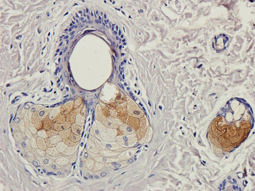 CD166 Rabbit Polyclonal Antibody