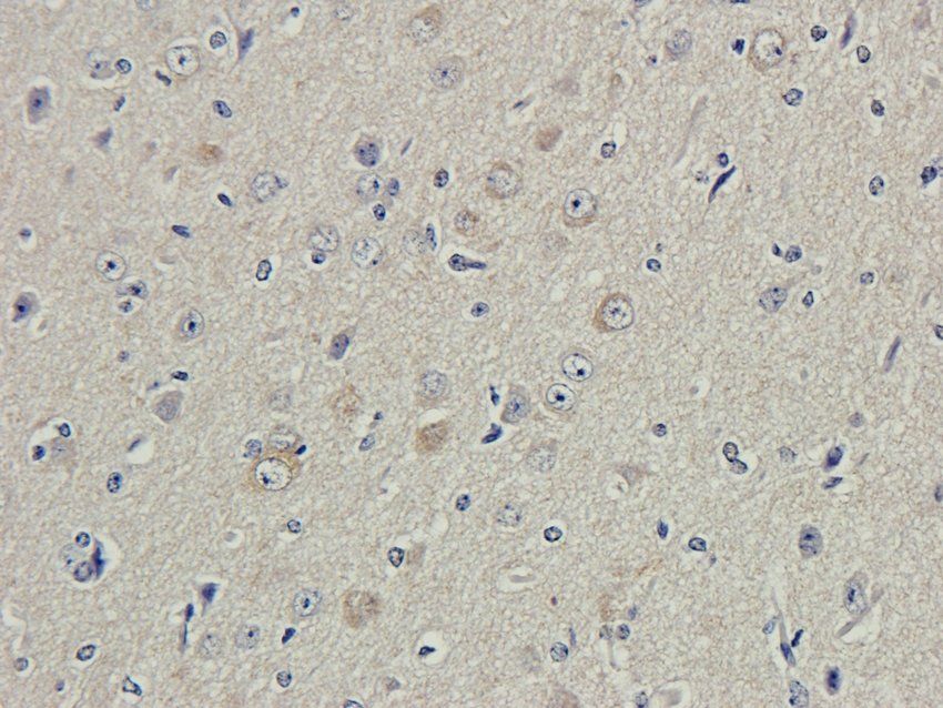 CD166 Rabbit Polyclonal Antibody