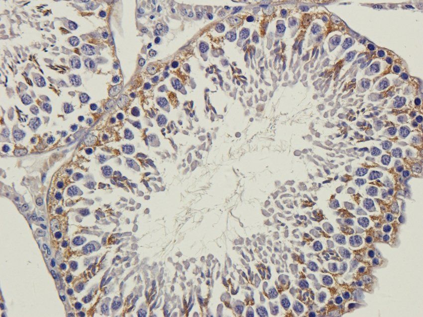 CD168 Rabbit Polyclonal Antibody
