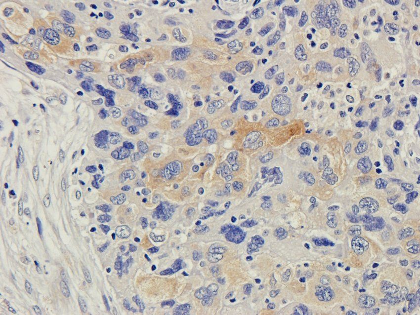 CD168 Rabbit Polyclonal Antibody