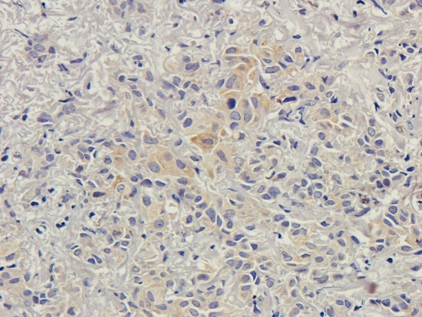 CD168 Rabbit Polyclonal Antibody