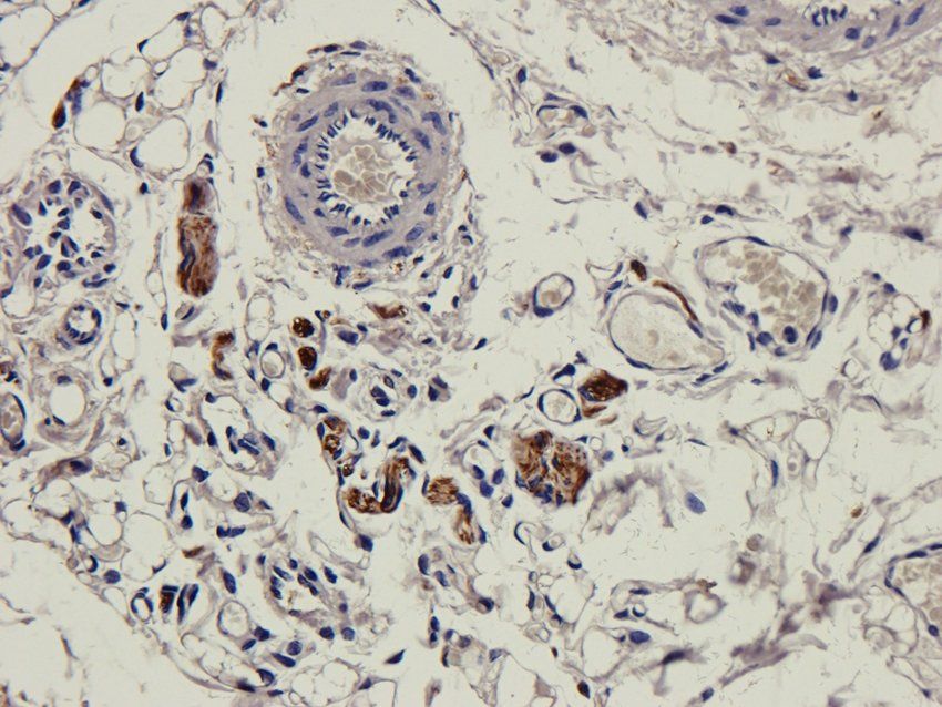 CD168 Rabbit Polyclonal Antibody