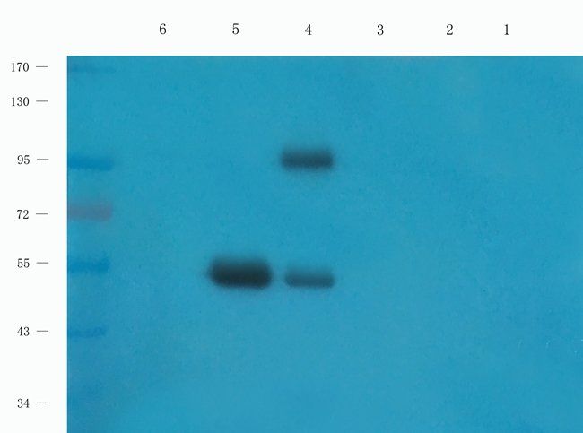 CD168 Rabbit Polyclonal Antibody