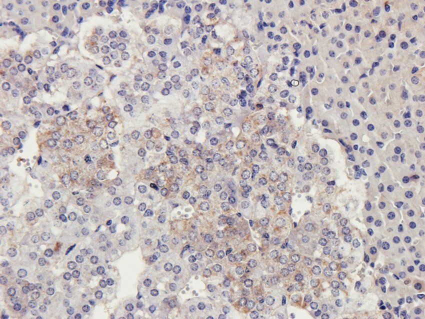 CD169 Sialoadhesin Rabbit Polyclonal Antibody