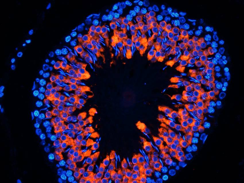 CD184/CXCR4 Rabbit Polyclonal Antibody