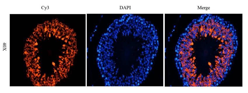 CD184/CXCR4 Rabbit Polyclonal Antibody