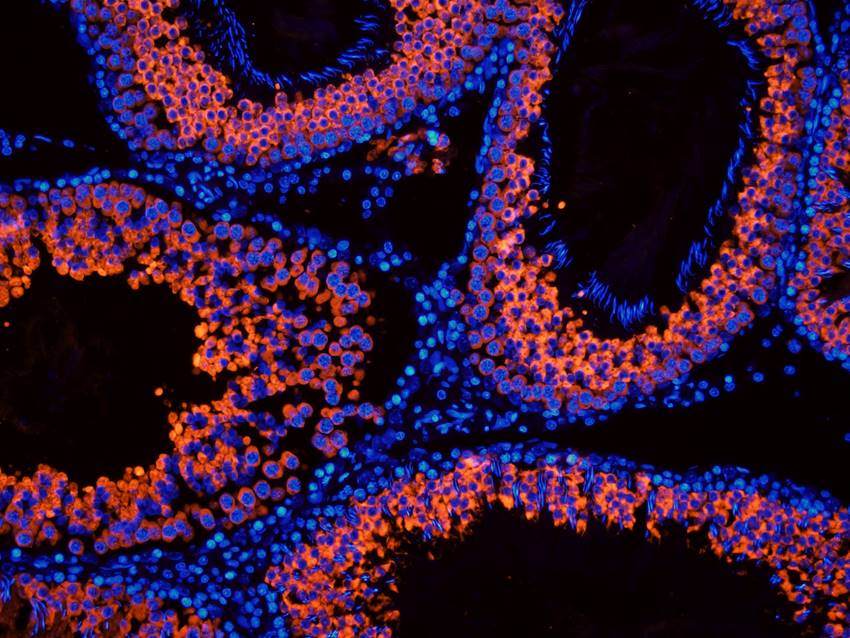 CD184/CXCR4 Rabbit Polyclonal Antibody
