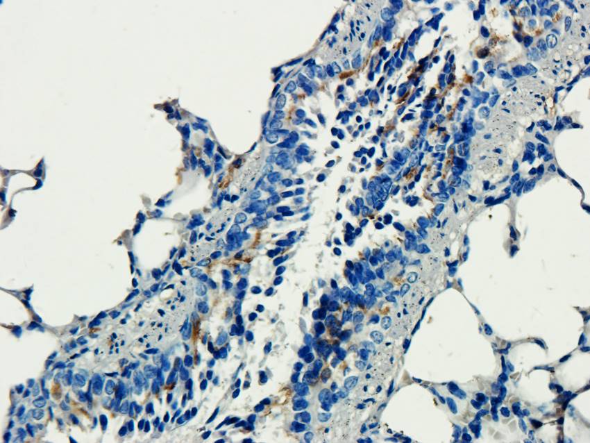 CD184/CXCR4 Rabbit Polyclonal Antibody