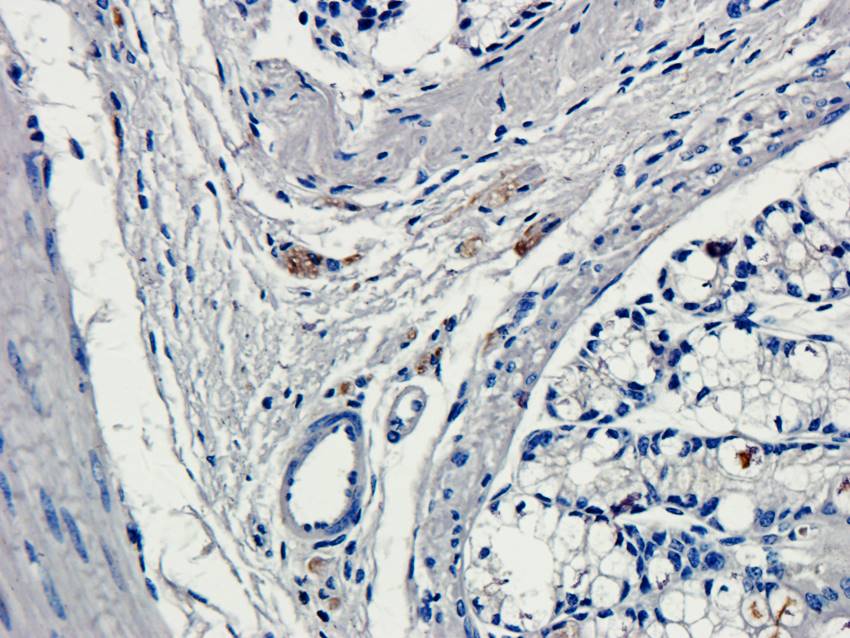 CD184/CXCR4 Rabbit Polyclonal Antibody