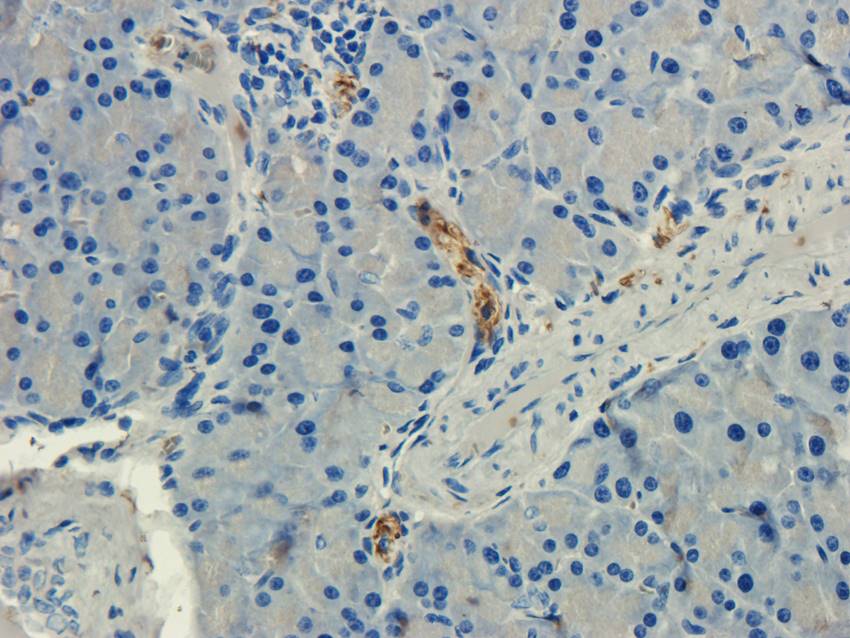 CD184/CXCR4 Rabbit Polyclonal Antibody