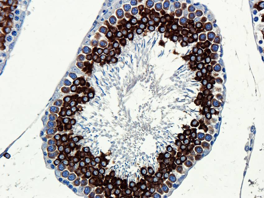 CD184/CXCR4 Rabbit Polyclonal Antibody