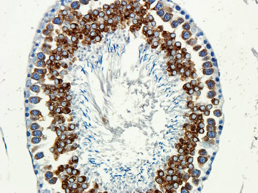 CD184/CXCR4 Rabbit Polyclonal Antibody