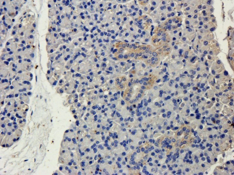 CD19 Rabbit Polyclonal Antibody