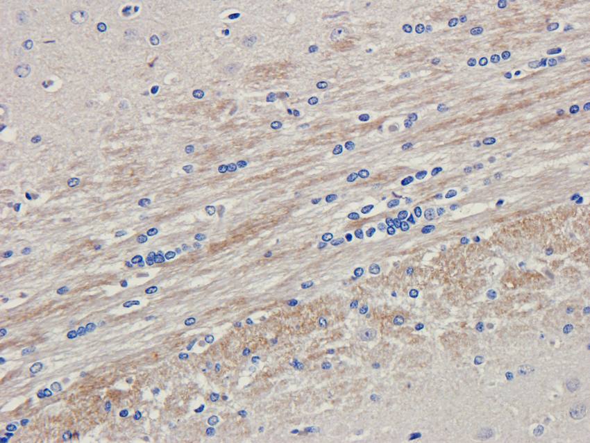 LHCGR Rabbit Polyclonal Antibody
