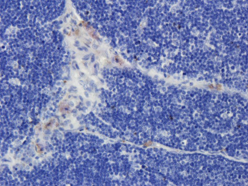 CD19 Rabbit Polyclonal Antibody