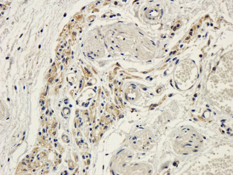 CD19 Rabbit Polyclonal Antibody