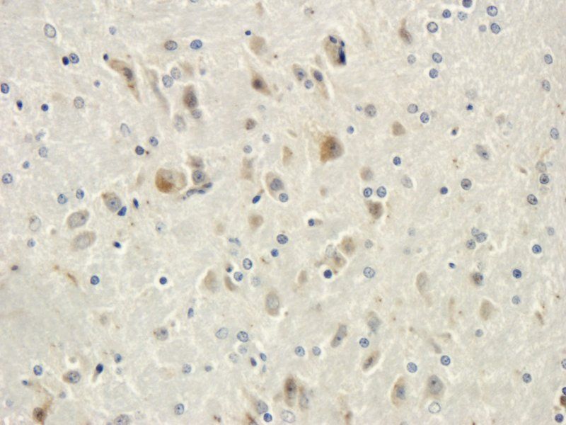 CD19 Rabbit Polyclonal Antibody