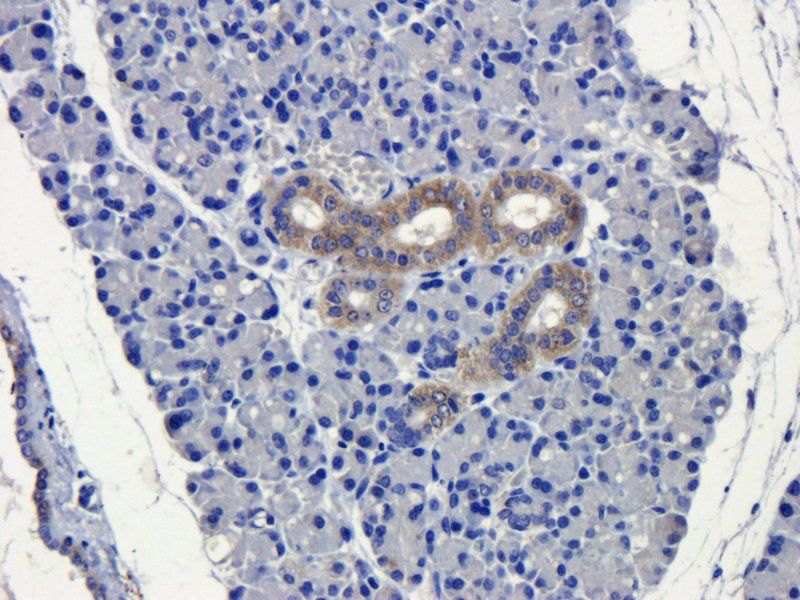 CD19 Rabbit Polyclonal Antibody