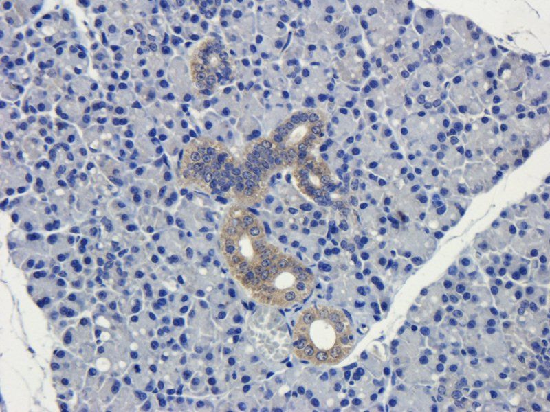 CD19 Rabbit Polyclonal Antibody
