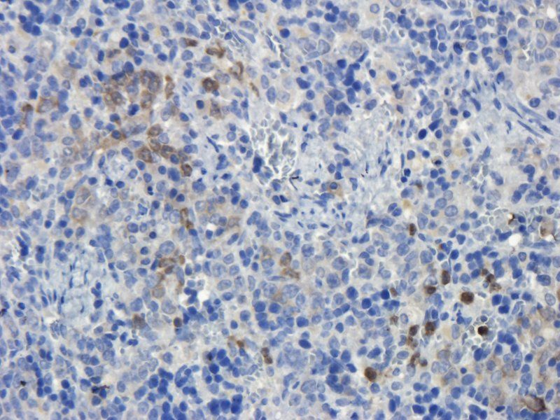 CD19 Rabbit Polyclonal Antibody