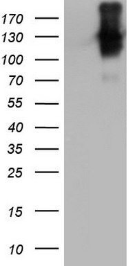 CD20 Antibody