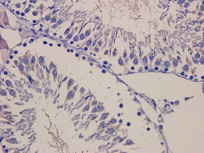 CD200 Rabbit Polyclonal Antibody