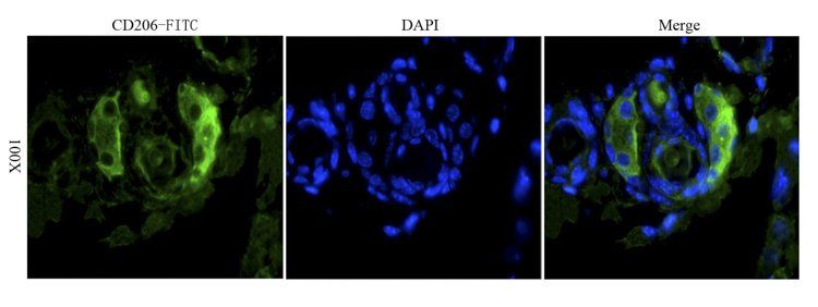 CD206 Rabbit Polyclonal Antibody (FITC)