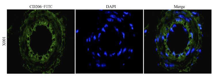CD206 Rabbit Polyclonal Antibody (FITC)