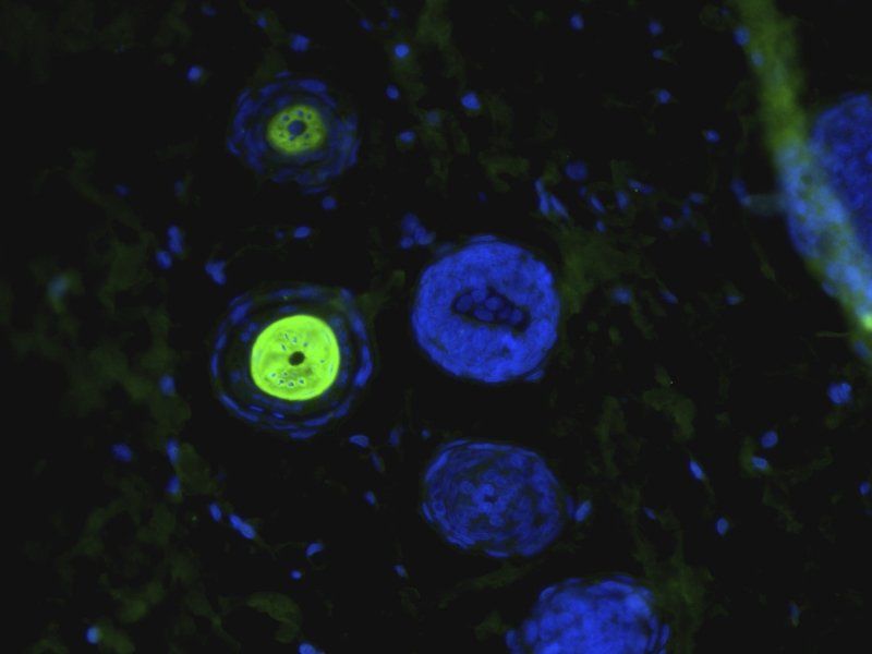 CD206 Rabbit Polyclonal Antibody (FITC)
