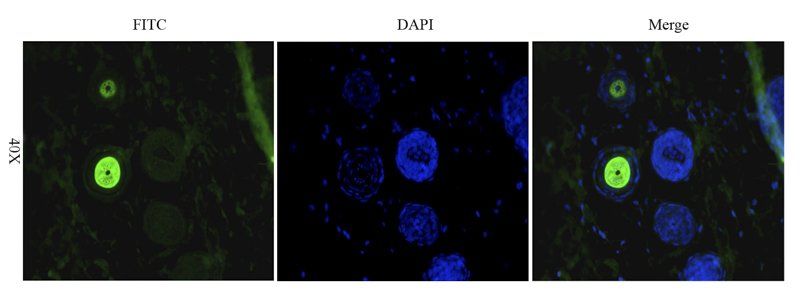 CD206 Rabbit Polyclonal Antibody (FITC)