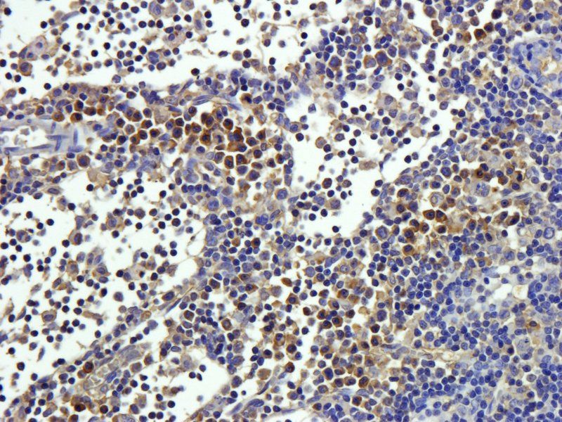 CD20 Rabbit Polyclonal Antibody