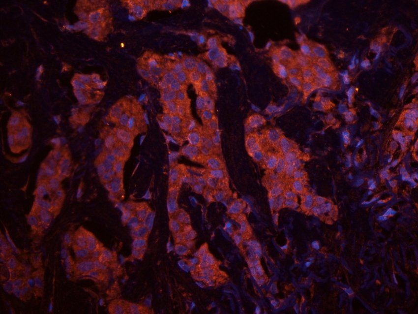 CD213a2 Rabbit Polyclonal Antibody